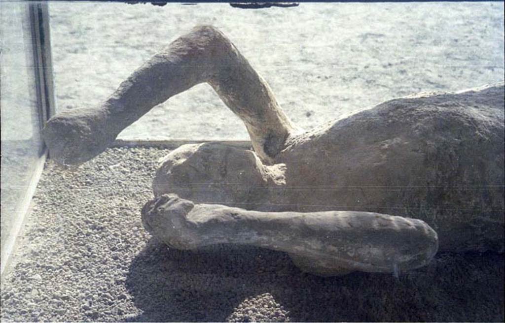 Victim 14. July 2011. 
Detail of head and upper body of plaster cast of victim 14 photographed on display in north-west corner of Macellum, but found near Stabian Gate.
Photo courtesy of Rick Bauer.