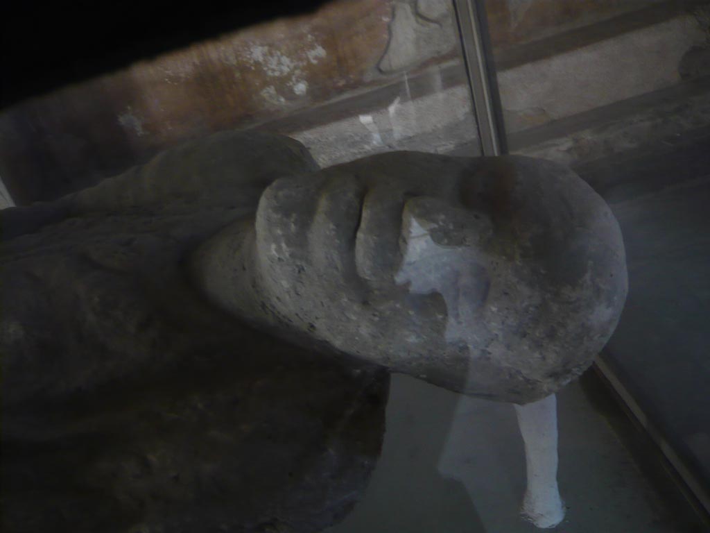 VII.1.8 Pompeii. May 2012. Victim 15. Detail of head of plaster cast of body, in men’s changing room 2. 
Photo courtesy of Buzz Ferebee.