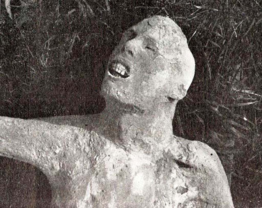 Cast of body no. 4, victim 57, found outside Porta Nola near tomb of Obellius Firmus. According to De Caro, the face shows the dramatic image of the pangs of death.
See De Caro S., 1979. Scavi nell’area fuori Porta Nola a Pompei: Cronache Pompeiane V, (fig. 26).
