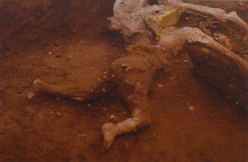 Oplontis, Villa of Lucius Crassius Tertius. Incomplete resin cast of a child found in 1984.