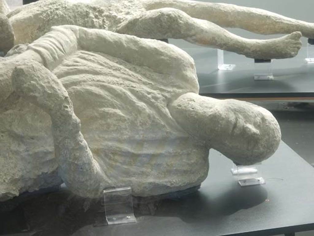 Pompeii. May 2018. Detail of Victim known as number 16, found outside the Stabian Gate. 
Photo courtesy of Buzz Ferebee.