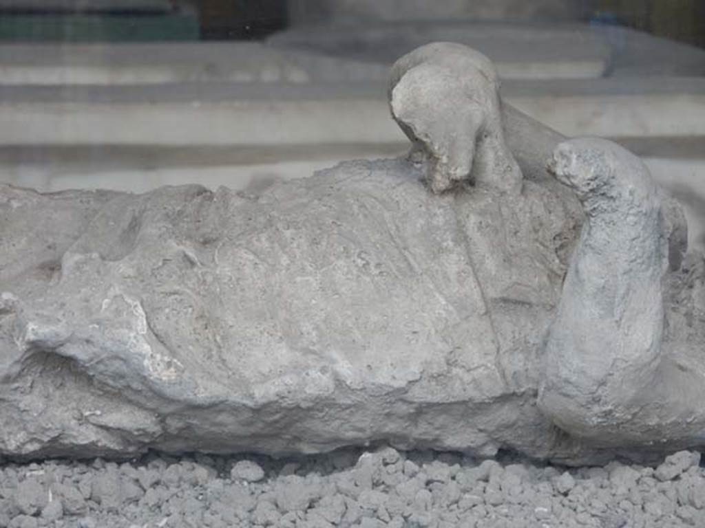 VII.7.29 Pompeii. May 2015. Detail from plaster cast of body of child found in VI.17.42.
Photo courtesy of Buzz Ferebee.