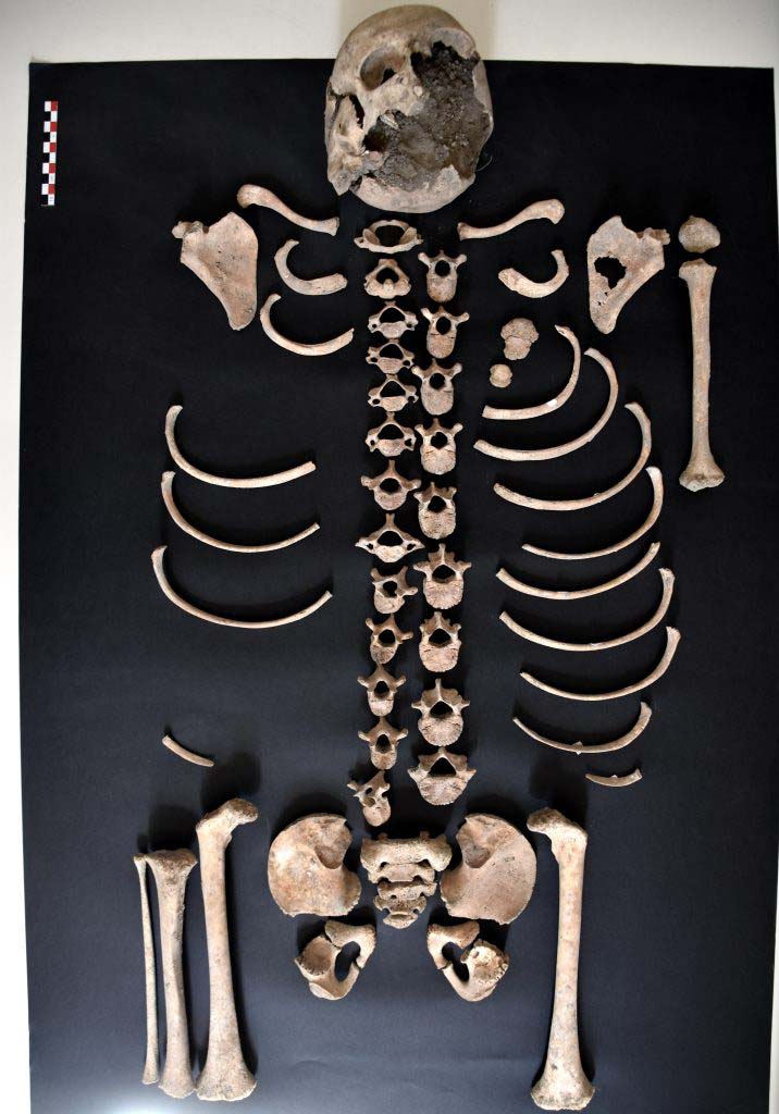 IX.4.18 Pompeii. 2018. Skeleton found outside room “n”. 
Laboratory studies of the skeleton based on the measurement of the long bones and on dental development have allowed the PAP to estimate the age as 7-8 years old.
Photograph © Parco Archeologico di Pompei.