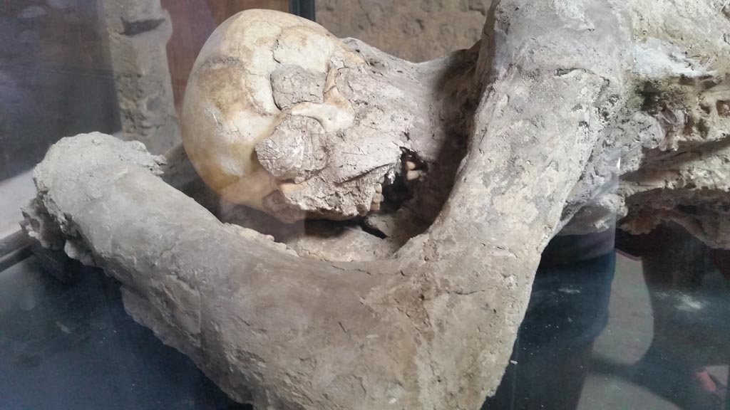 Villa of Mysteries, Pompeii. August 2016. 
Room 64, detail of plaster-cast of a body of a man found in Room 35. Photo courtesy of Maribel Velasco.