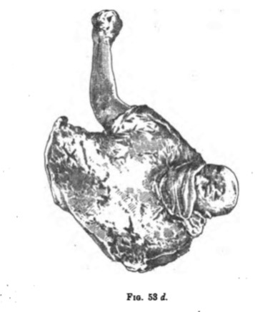 Villa della Pisanella, Boscoreale. Cast of man wearing a cloak and with clenched fist.
See Notizie degli Scavi di Antichità, 1895, Fig.53d.